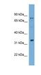 Sperm Acrosome Associated 1 antibody, NBP1-79331, Novus Biologicals, Western Blot image 