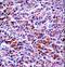 Serine Protease 2 antibody, LS-C162191, Lifespan Biosciences, Immunohistochemistry paraffin image 