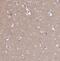 CSF3R antibody, NBP2-33513, Novus Biologicals, Immunohistochemistry paraffin image 