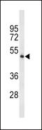 Tryptophan Hydroxylase 2 antibody, MBS9205976, MyBioSource, Western Blot image 