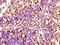 Signal-Induced Proliferation-Associated 1 antibody, CSB-PA021330LA01HU, Cusabio, Immunohistochemistry frozen image 