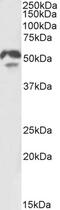 Hepatocyte Nuclear Factor 4 Alpha antibody, PA5-18363, Invitrogen Antibodies, Western Blot image 