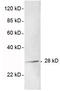 Thiopurine S-Methyltransferase antibody, LS-C203085, Lifespan Biosciences, Western Blot image 