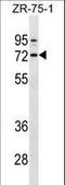 Selectin E antibody, LS-C158938, Lifespan Biosciences, Western Blot image 