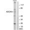 Coenzyme Q8B antibody, PA5-49869, Invitrogen Antibodies, Western Blot image 