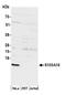 S100 Calcium Binding Protein A16 antibody, NBP2-60725, Novus Biologicals, Western Blot image 