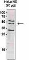 WD Repeat Domain 5 antibody, CI1087, Boster Biological Technology, Western Blot image 