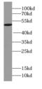 UBX Domain Protein 6 antibody, FNab09212, FineTest, Western Blot image 