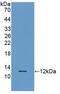 Regulated On Activation In Normal T-Cell Expressed And Secreted  antibody, MBS2026312, MyBioSource, Western Blot image 