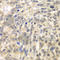 Tousled Like Kinase 2 antibody, A6770, ABclonal Technology, Immunohistochemistry paraffin image 