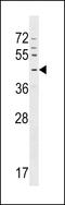 G Protein-Coupled Receptor 63 antibody, LS-C159773, Lifespan Biosciences, Western Blot image 