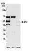 p53 antibody, A300-248A, Bethyl Labs, Western Blot image 
