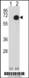 Ret Proto-Oncogene antibody, 56-557, ProSci, Western Blot image 