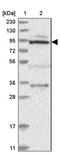 Mitochondrial TRNA Translation Optimization 1 antibody, PA5-56409, Invitrogen Antibodies, Western Blot image 