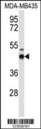 Gamma-Aminobutyric Acid Type A Receptor Delta Subunit antibody, 63-881, ProSci, Western Blot image 