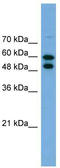 Phosphoglucomutase 1 antibody, TA337679, Origene, Western Blot image 