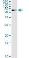 Phosphoglucomutase 1 antibody, H00005236-M01, Novus Biologicals, Immunoprecipitation image 