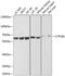 Cytochrome P450 Family 1 Subfamily B Member 1 antibody, GTX64767, GeneTex, Western Blot image 