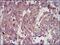 Insulin Like Growth Factor 2 antibody, NBP2-37462, Novus Biologicals, Immunohistochemistry paraffin image 