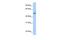 Mitochondrial sodium/hydrogen exchanger NHA2 antibody, GTX45540, GeneTex, Western Blot image 