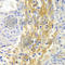 Filamin A antibody, A7896, ABclonal Technology, Immunohistochemistry paraffin image 