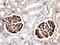 Apolipoprotein A1 antibody, PB9845, Boster Biological Technology, Immunohistochemistry paraffin image 