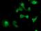 Suppressor Of Cytokine Signaling 3 antibody, NBP2-00817, Novus Biologicals, Immunocytochemistry image 