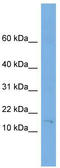 Fragile Histidine Triad Diadenosine Triphosphatase antibody, TA339874, Origene, Western Blot image 