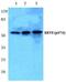 Keratin 8 antibody, PA5-36799, Invitrogen Antibodies, Western Blot image 