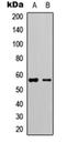 C-X3-C Motif Chemokine Receptor 1 antibody, orb74362, Biorbyt, Western Blot image 