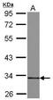 3-Hydroxyisobutyrate Dehydrogenase antibody, GTX122995, GeneTex, Western Blot image 