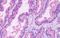 G Protein-Coupled Receptor Class C Group 5 Member A antibody, GTX71141, GeneTex, Immunohistochemistry paraffin image 