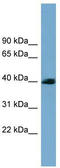 SAM And SH3 Domain Containing 3 antibody, TA344829, Origene, Western Blot image 