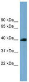 SAM and SH3 domain-containing protein 3 antibody, TA344829, Origene, Western Blot image 