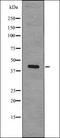 Acyl-CoA Dehydrogenase Medium Chain antibody, orb339205, Biorbyt, Western Blot image 