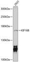 Kinesin Family Member 16B antibody, 13-573, ProSci, Western Blot image 