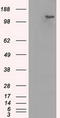 BUB1 Mitotic Checkpoint Serine/Threonine Kinase B antibody, TA500586S, Origene, Western Blot image 