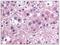 Interleukin-25 antibody, AM06000PU-N, Origene, Immunohistochemistry frozen image 