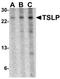 Thymic Stromal Lymphopoietin antibody, AP22809PU-N, Origene, Western Blot image 