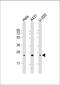 RAB1B, Member RAS Oncogene Family antibody, M04589, Boster Biological Technology, Western Blot image 