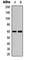 AKT1/2 antibody, abx133025, Abbexa, Western Blot image 