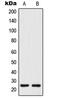 Tetraspanin 8 antibody, GTX56175, GeneTex, Western Blot image 