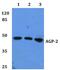 Orosomucoid 2 antibody, PA5-37124, Invitrogen Antibodies, Western Blot image 