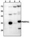 Prostate Transmembrane Protein, Androgen Induced 1 antibody, PA5-75980, Invitrogen Antibodies, Western Blot image 