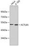 Actin Like 6A antibody, 18-581, ProSci, Western Blot image 