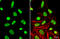 X-Ray Repair Cross Complementing 5 antibody, GTX109935, GeneTex, Immunofluorescence image 