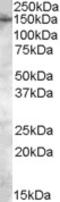 Transient Receptor Potential Cation Channel Subfamily M Member 7 antibody, orb18297, Biorbyt, Western Blot image 