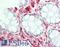 Ring Finger Protein 4 antibody, LS-B10482, Lifespan Biosciences, Immunohistochemistry paraffin image 