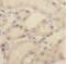 Eukaryotic Translation Initiation Factor 4A3 antibody, FNab02719, FineTest, Immunohistochemistry paraffin image 