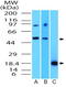 Transcription factor SOX-11 antibody, TA337213, Origene, Western Blot image 